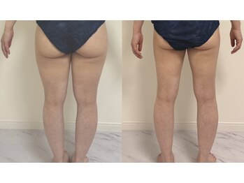 プリマルーチェ/プレミアム下半身プログラム