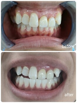 エクシアホワイトニング 石巻店/ホワイトニングサロン　石巻店