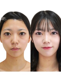 メゾンカラクル/お客様before→after