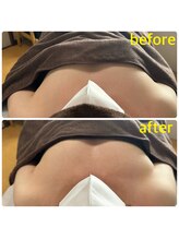 エヌ(N)/【バストアップ】