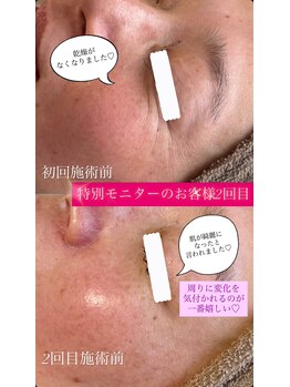 パタティパタタ(PatatiPatata)/綺麗になったと言われた!