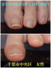 巻き爪じゅん 船橋店/巻き爪の痛み改善で笑顔に！