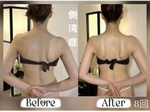 一般的な整体や機器では解決できない側湾の方へ。『駆け込み寺』