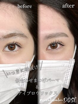 ドース(DOSE)/別人級に可愛くなる！