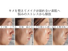 ユウビジン(YOU美人)/