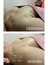 チュラ 大宮店(Chura)/【50代】バストアップ5回目@大宮