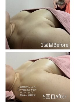 チュラ 大宮店(Chura)/【50代】バストアップ5回目@大宮