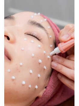 クレビア(CREBIA)/【シミ・シミケア専門店】沖縄県