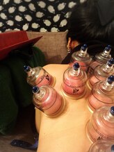 ラブロ(Rabro)/カッピング