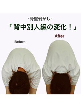 アサバ整体院 八潮店(ASABA整体院)/骨盤剥がし結果写真