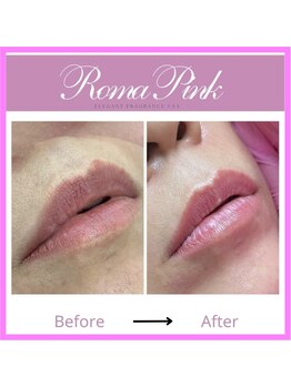 エステレア(Esthelea)/Roma Pink ローマピンク