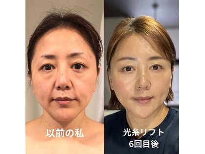 ホルバールウェルネス(Hallbar Wellness)の写真