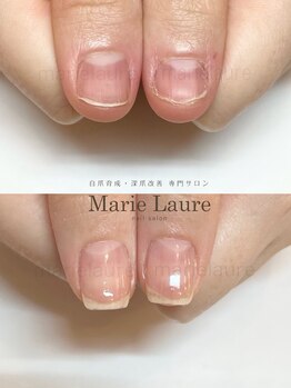 マリーロール 天王寺店(Marie Laure)/深爪改善/自爪育成/ネイルケア