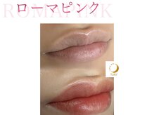 ツキ(TUKI+)/ローマピンク★全身の黒ずみ除去