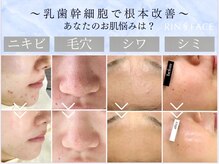 リンフェイス 銀座店(RIN FACE)