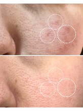 リム ビューティー(RYM BEAUTY)/お肌のシミ、くすみ、毛穴ケアに