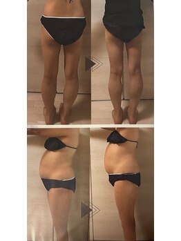 ヨサパーク リアン(YOSA PARK Lien)/モニター様before→after/痩身