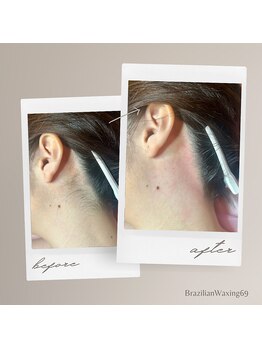 ブラジリアンワキシング シックスナイン(BrazilianWaxing69)/女性 / うなじ