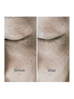 リエル(RiEL)/エイジングのお悩みに