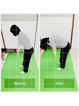 門前仲町イエティ鍼灸整骨院（旧：イエティ鍼灸整骨院）/ビフォーアフター♪