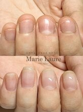 マリーロール 梅田店(Marie Laure)/自爪育成/深爪矯正/ネイルケア