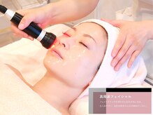 リリィブラン(Lily branc)/小顔フェイシャル