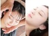 【お顔のことならお任せ】美容鍼×小顔矯正　16000→5000