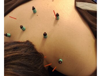 リマホオラシンキュウセイコツイン(lima ho ola鍼灸整骨院)