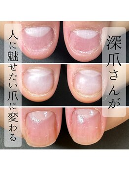 ヴィヴィアナ(VIVIANA)/来店が美爪の第一歩