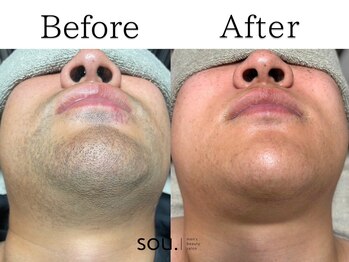 ソウ 越前店(sou.)/