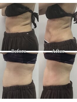 フィッツ 多治見店(fit's)/健康エステ