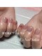 深爪ケア専門ネイルサロン E's Nail Salonの写真/【爪のお悩み解決特化】深爪・むしり癖・形が悪い…コンプレックスを根本改善し、憧れの美爪へと育成★