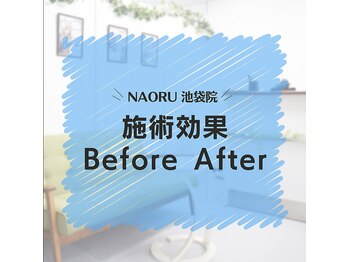 ナオル整体 池袋院(NAORU整体)/凝りにくい体づくり!【池袋】
