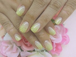 【川崎】キラキラ☆イエロー