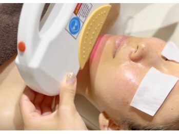 プルプル(purupuru)/顔脱毛