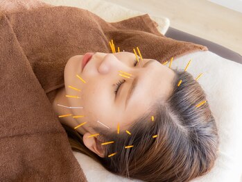 アボット(ABBOTT)