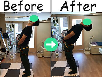 杉本接骨鍼灸院/施術後、体が軽く自由に動いた