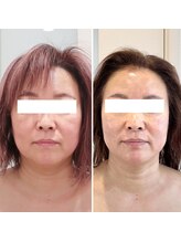 ドクターボディ 新宿店(Dr.Body)/美骨形成×ポレーション