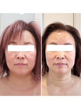 ドクターボディ 新宿店(Dr.Body)/美骨形成×ポレーション