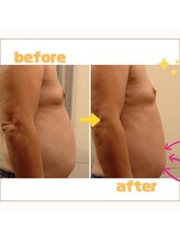 ホクラニ(Hokulani)/キャビラジでぽっこりお腹を撃退