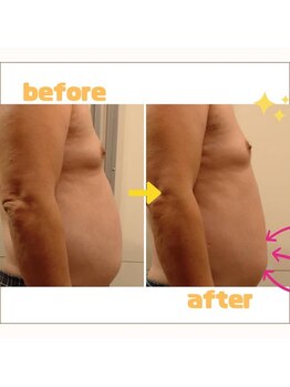 ホクラニ(Hokulani)/キャビラジでぽっこりお腹を撃退