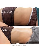 プランツ(PLANTS)/50代／１回／お腹ケア