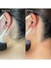 オフショルの季節に人気のセットをワックス＋光脱毛で！肩回り+うなじ