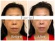 モニカワクシング(MonicaWaxing)の写真