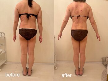 クロレ 浦和店(CLORE)/30代のお客様/12回施術