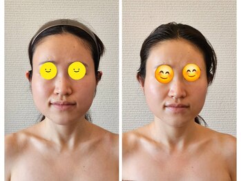 金梨花サロン/顔の輪郭すっきり!