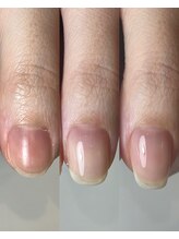 シー(sea)/自爪育成