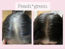 ピーチ グリーン(Peach green)の雰囲気（スカルプケアも大人気です！ご自身の大切な髪を元気にしたい方！）