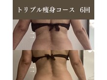 サロンドペシェ(salon de peche)/トリプル痩身コース6回の変化