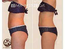 ナースのロミリンパ